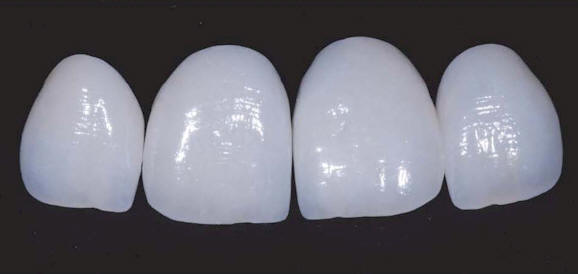 arti01010