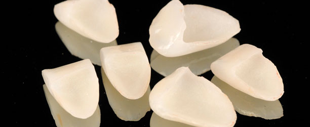 las-carillas-de-porcelana