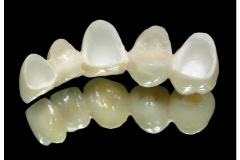 9064938