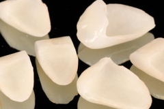 Cópia de las-carillas-de-porcelana