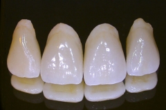 Porcelain_Dental_Crowns