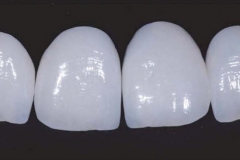arti01010