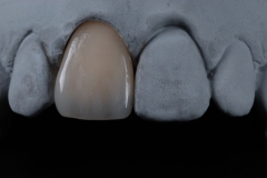 e.Maxveneerlb[1]