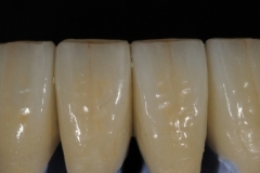 medium_ips-emax[1]