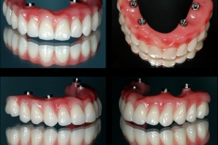protocolo superior-1
